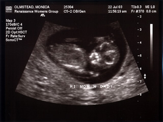 Baby Mojo